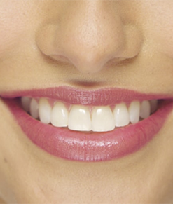 Son Clinique Màu Tím Hồng