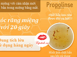 nuoc-suc-mieng-propolinse-mau-cam