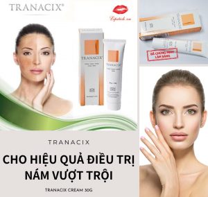 Kem Trị Nám Tranacix Cream 30g