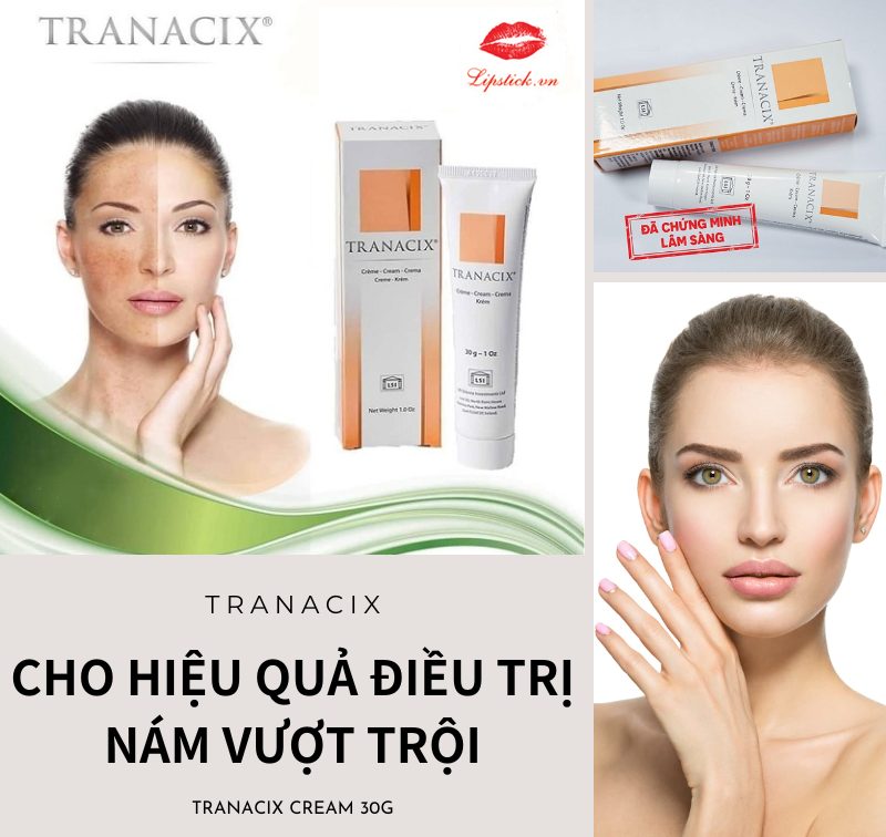 Kem Trị Nám Tranacix Cream 30g